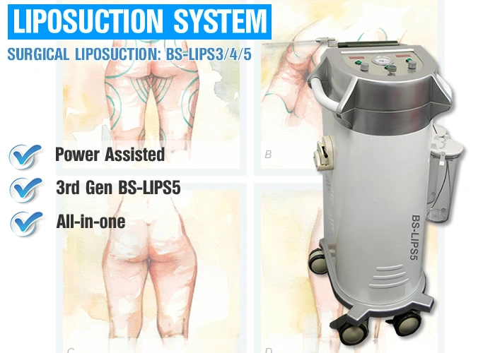 Fat Grafting Resonance Ancillary Surgical Liposuction Machine for Body Slimming