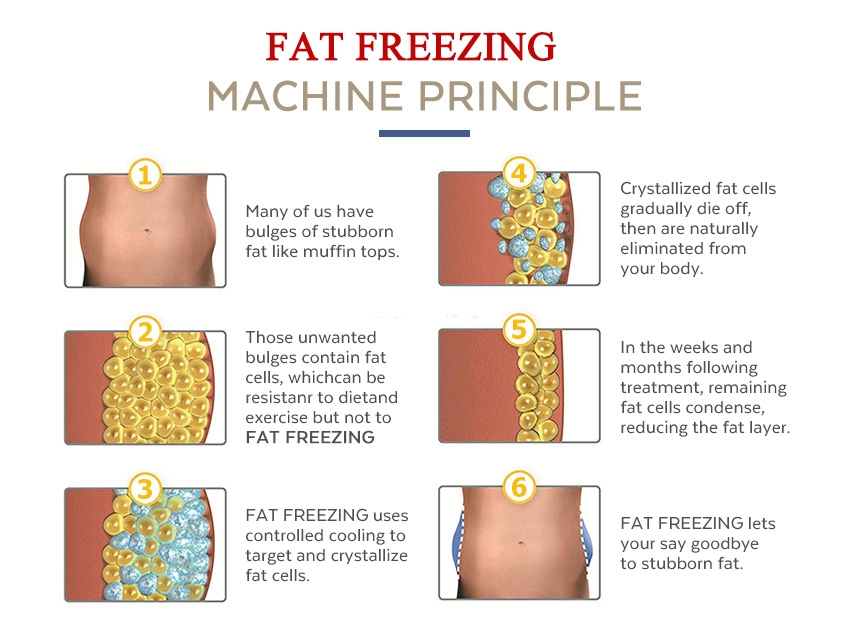 Criolipolisis Machine Cryolipolysis Price with Cavitation RF Lipolaser