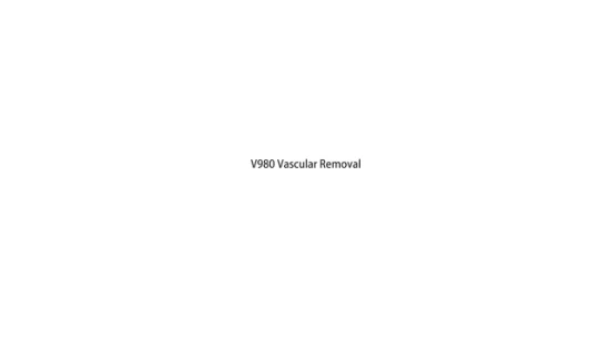 980nm Diode Laser Vascular and Spider Vein Removal