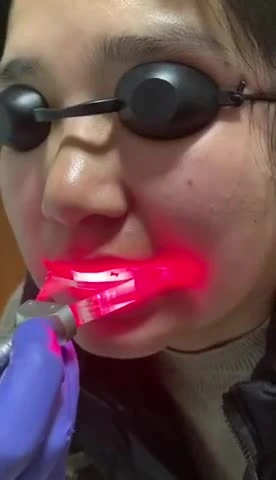 CE Approved 980nm Teeth Whitening Periodontal Disease Diode Laser Dental Machine